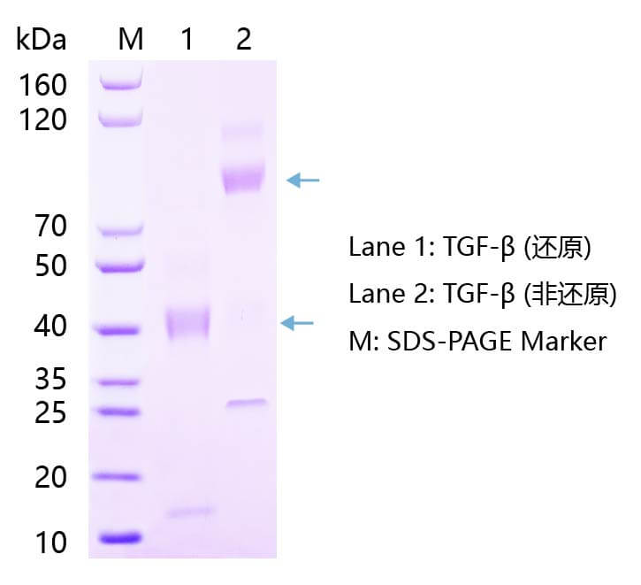 TGF-β1蛋白SDS-PAGE結果